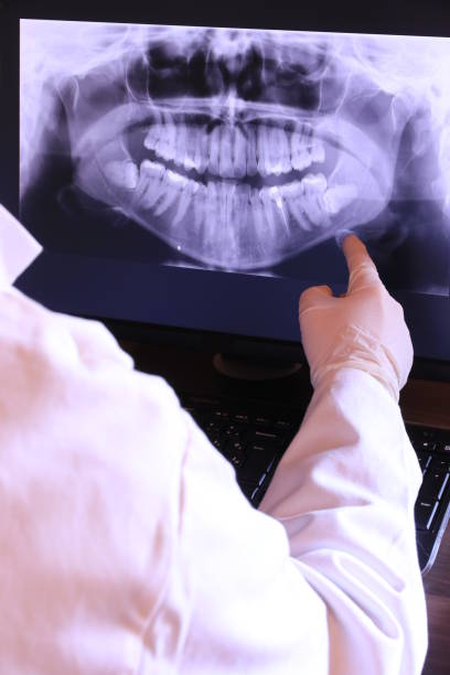 Best Emergency Wisdom Tooth Extraction in Richwood, NJ