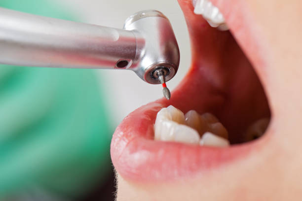 Best Emergency Dental Care for Sports Injuries in Richwood, NJ